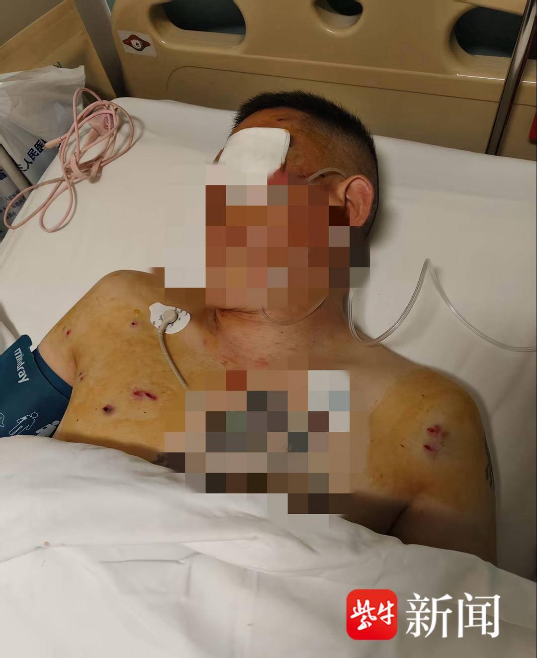 皇冠信用網代理
_紫牛头条｜男子取款170万在银行门口遭抢劫致重伤皇冠信用網代理
，当事人认为银行保安未帮忙应担责