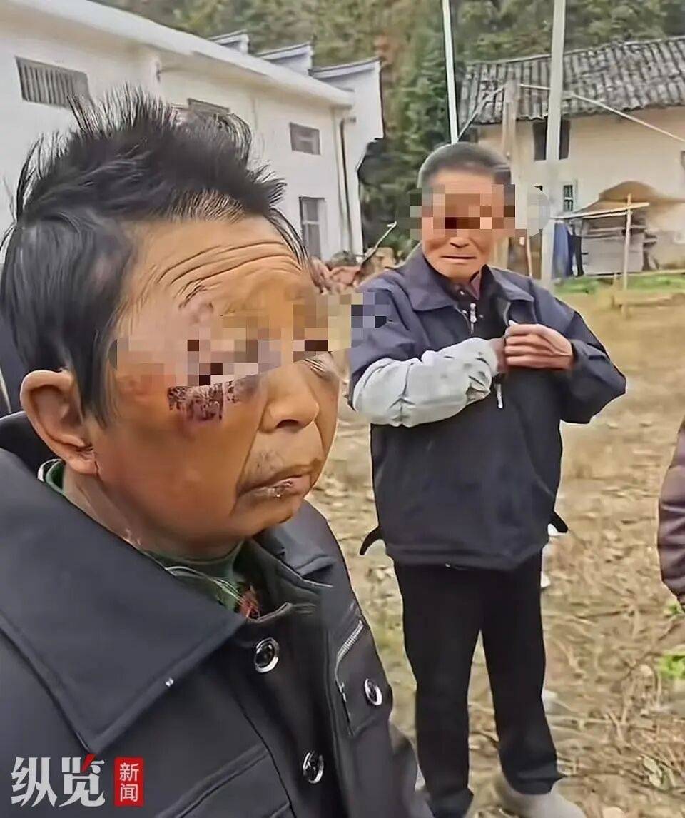 皇冠信用网开号_湖南一女子被75岁丈夫酒后两次家暴皇冠信用网开号，村民：女子被打从不还手，男子动手不是一次两次